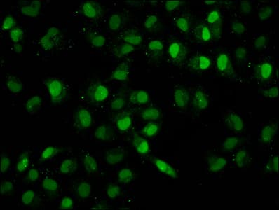 HIST1H2BN Antibody