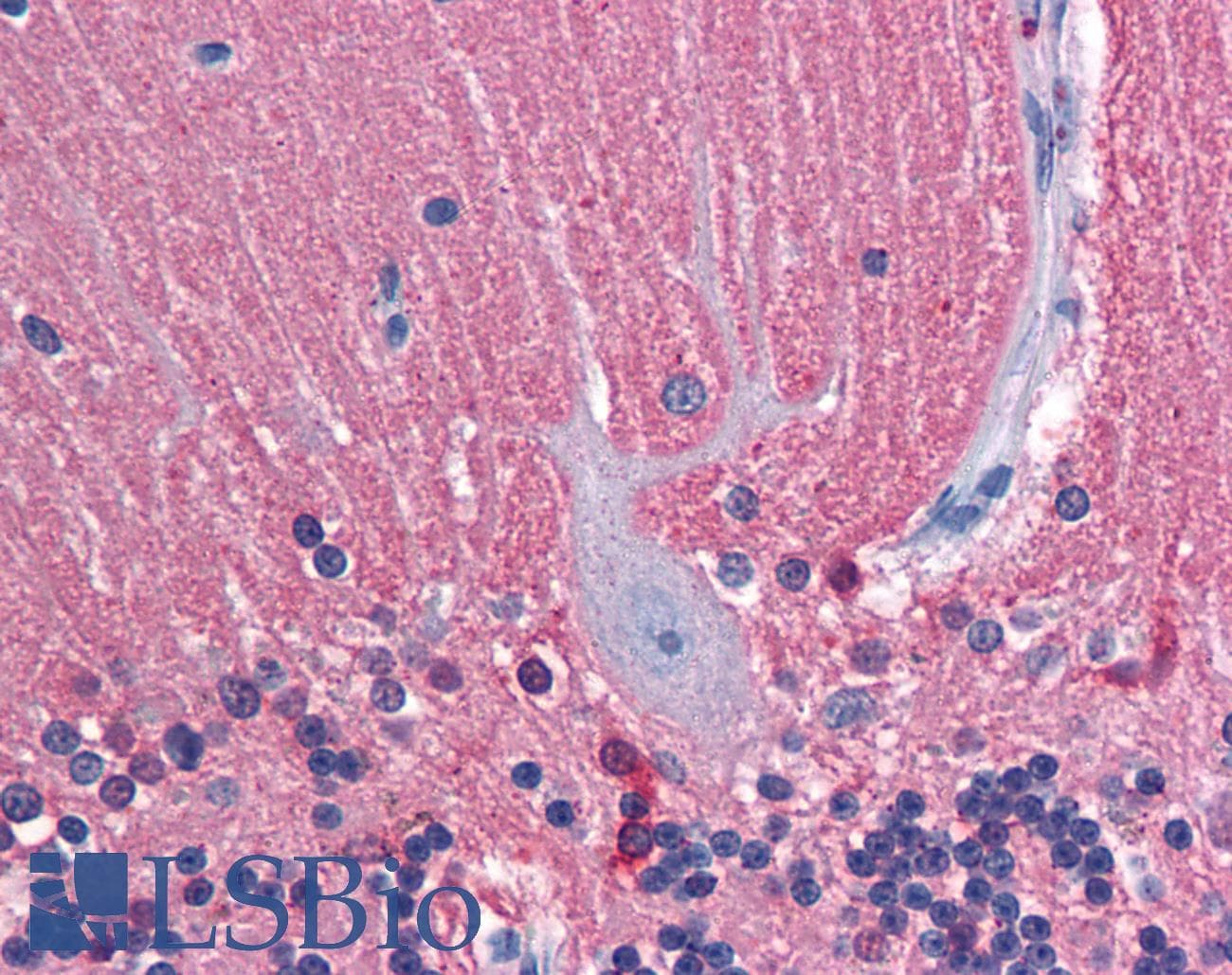 IHC-plus™ TUBB2A / Tubulin Beta 2A Antibody (clone 2B2)