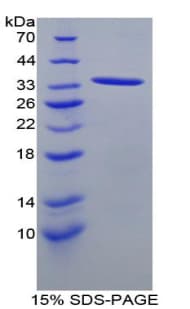 Rat ANGPTL1 Protein (Recombinant His-T7)