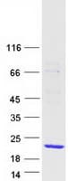 Human WTAP Protein (Recombinant Myc-DDK (Flag))