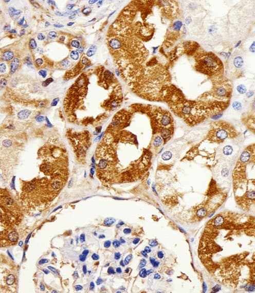 LIMK2 Antibody (aa570-599)