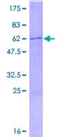 Human SPRY2 / Sprouty 2 Protein (Recombinant GST)