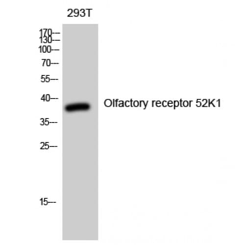 OR52K1 Antibody (170-250 aa, Internal)