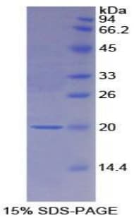 Rat CSF1R / CD115 / FMS Protein (Recombinant His)