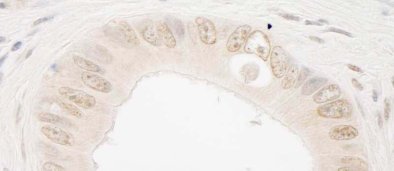 RAD54L2 Antibody (aa75-125)