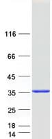 Human CYB5R3 / B5R Protein (Recombinant Myc-DDK (Flag))