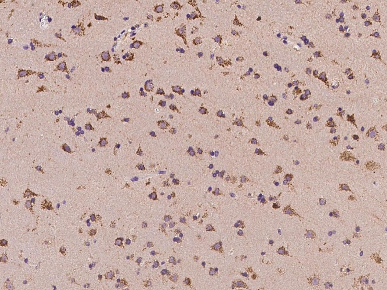 Polyclonal Rabbit anti-Human C11orf58 Antibody (IHC)