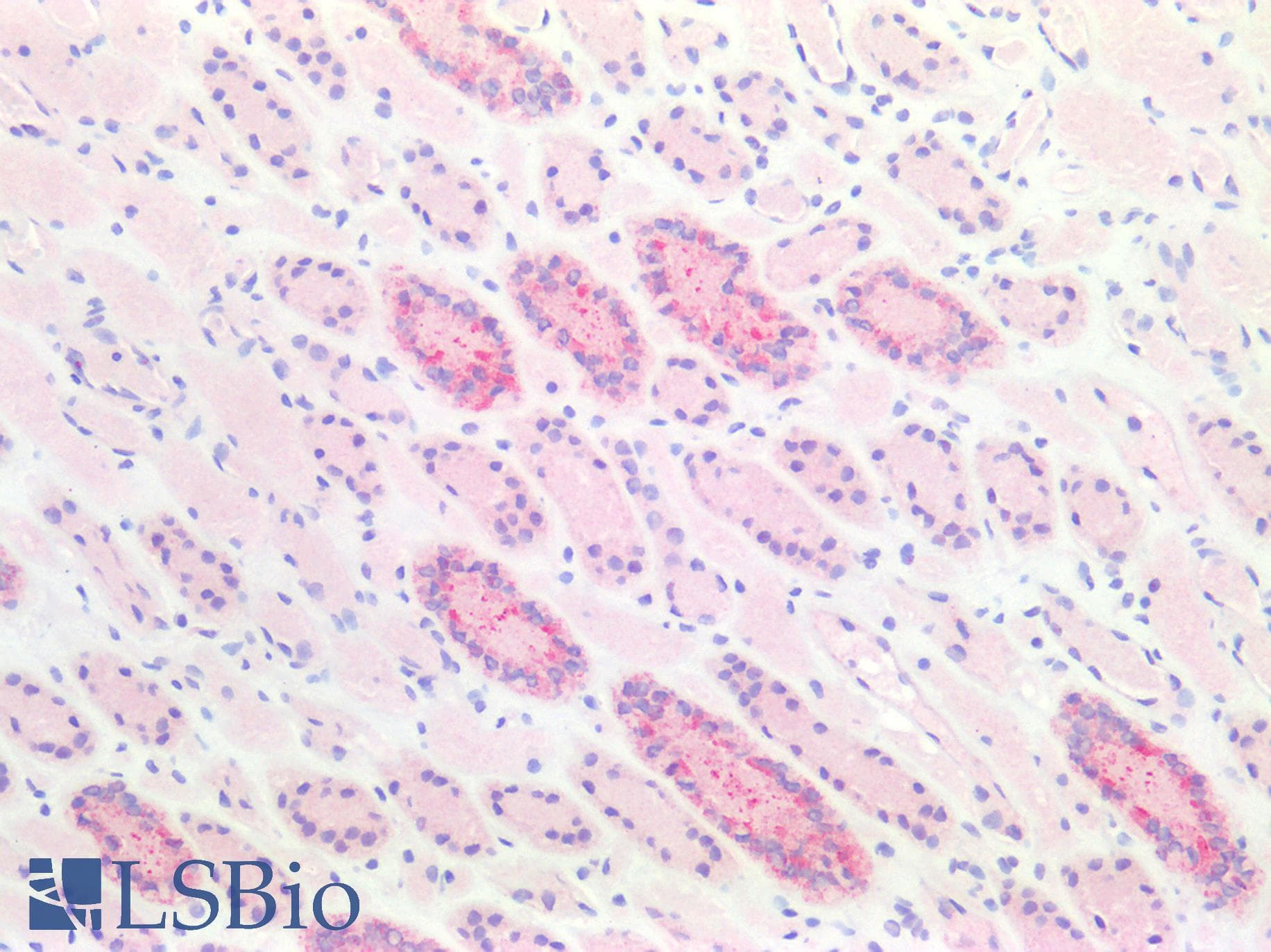 IHC-plus™ BCL2 / Bcl-2 Antibody