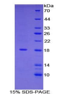 Human GMFG Protein (Recombinant His-T7)