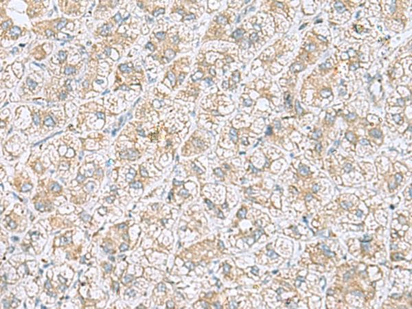 Polyclonal Rabbit anti-Human NDRG4 Antibody (IHC, WB)