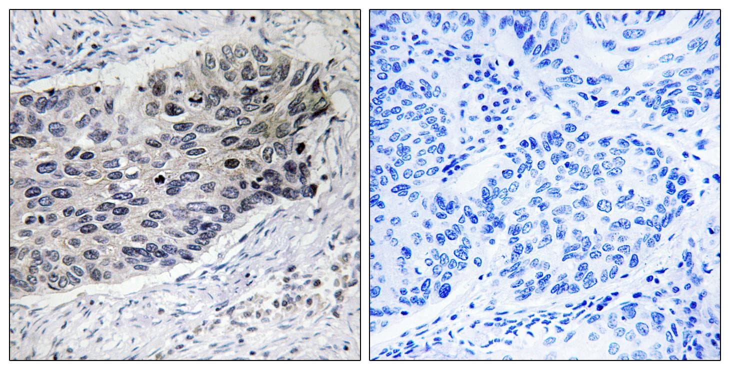 PC / Pyruvate Carboxylase Antibody
