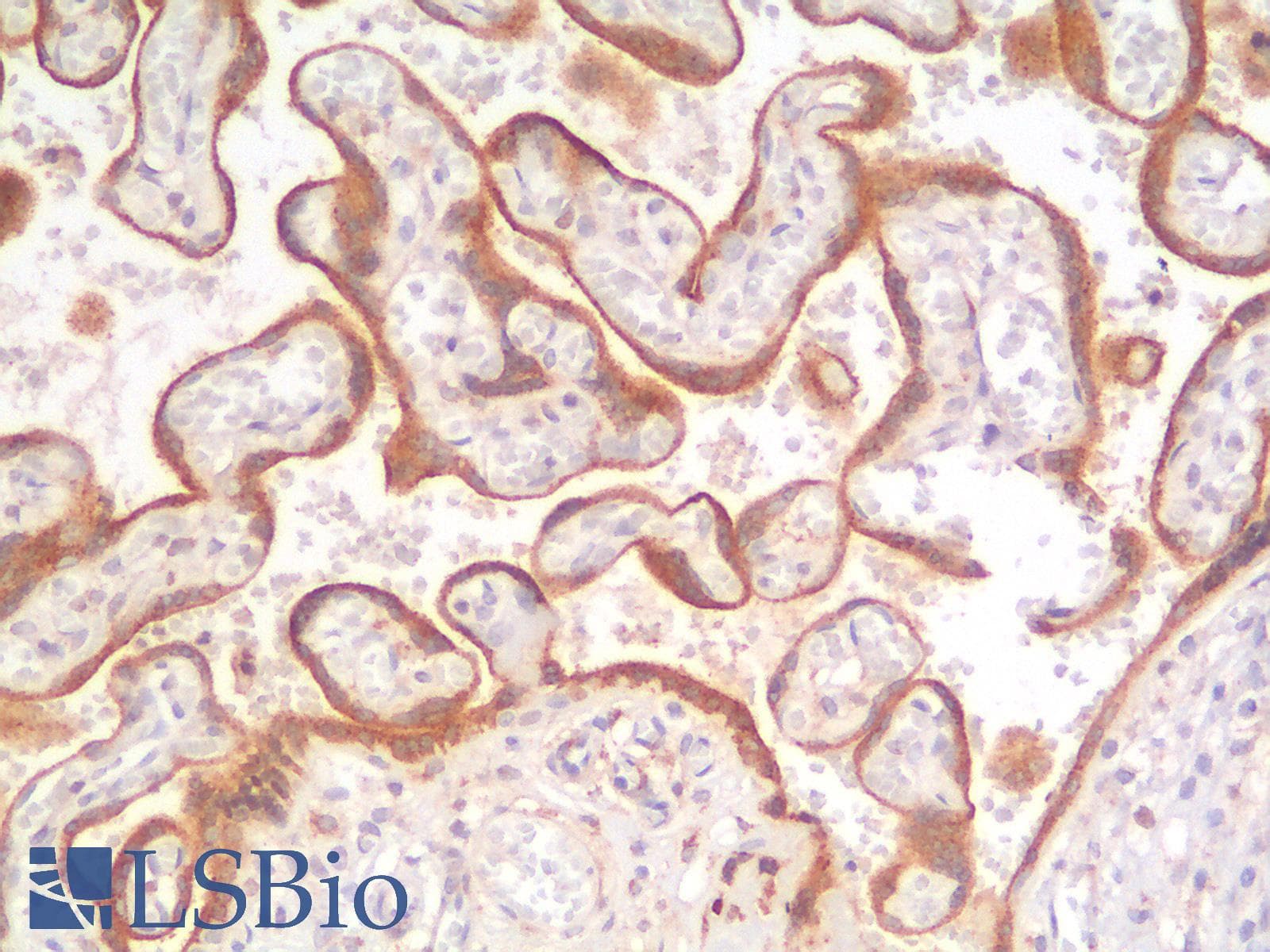 PathPlus™ Recombinant Monoclonal Mouse anti-Human GPC3 / Glypican 3 Antibody (clone rGPC3/863, IHC, IF)