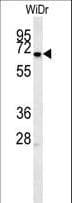 MEIS2 Antibody (aa254-280)
