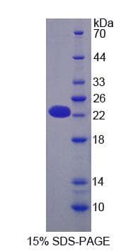 Mouse OPA3 Protein (Recombinant His-T7, N-terminus)