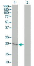 CYGB / Cytoglobin Antibody (clone 1A1)