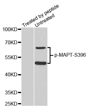 Polyclonal Rabbit anti-Human MAPT / Tau Antibody (phospho-Ser396, IHC, WB)
