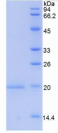 Mouse GDF15 Protein (Recombinant His-S)
