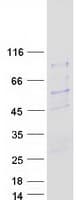 Human SIVA1 / SIVA Protein (Recombinant Myc-DDK (Flag))