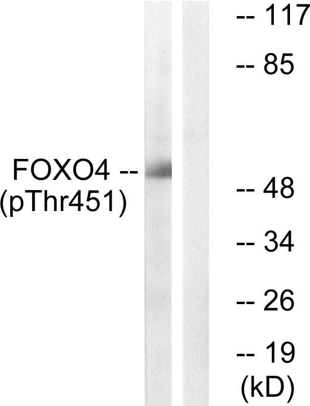 FOXO4 / AFX1 Antibody (phospho-Thr451)