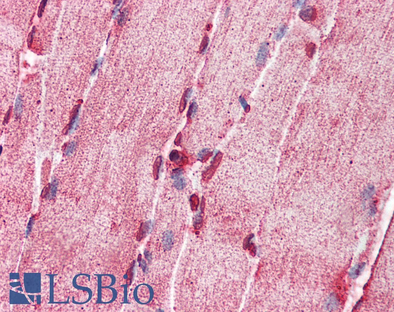 ACS5 / ACSL5 Antibody (aa470-519)