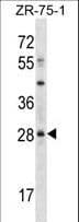 MSX2 / MSH Antibody (aa120-148)