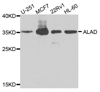Polyclonal Rabbit anti-Human ALAD Antibody (IHC, WB)