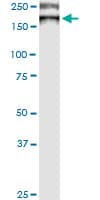 WC1 / ATP7B Antibody (clone 3E10)