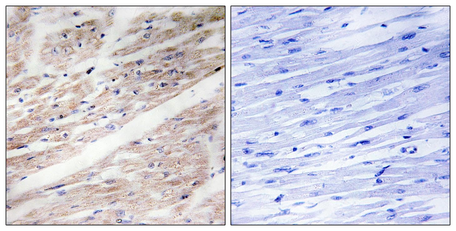 c-Kit / CD117 Antibody (phospho-Tyr936)