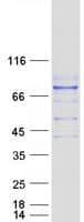 Human IL17RC Protein (Recombinant Myc-DDK (Flag))