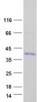 Human SNAI1 / SNAIL-1 Protein (Recombinant Myc-DDK (Flag))