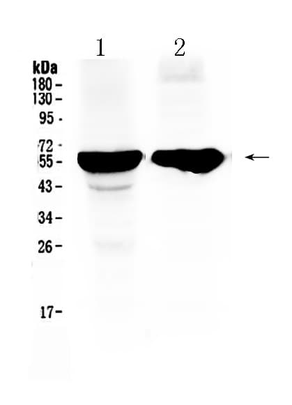 Polyclonal Rabbit anti-Human CYP2D6 Antibody (IHC, WB)
