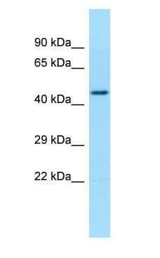 Polyclonal Rabbit anti-Human TBCEL / E-Like Antibody (aa232-281, WB)