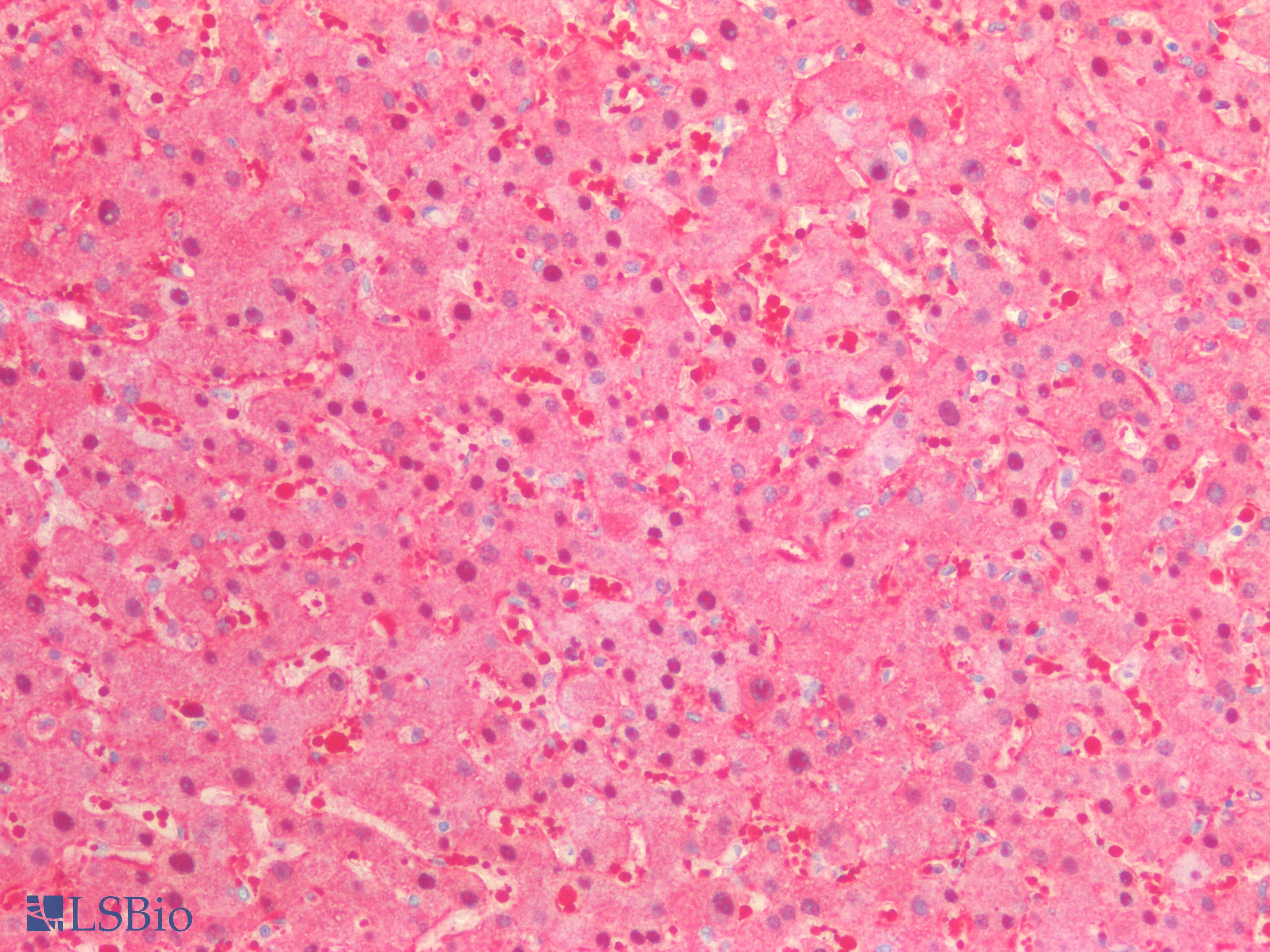 ARG1 / Arginase 1 Antibody