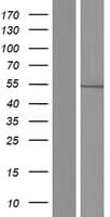 Human PH / PAH Protein (Over-Expression Lysate Myc-DDK (Flag))
