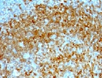 CD74 / CLIP Antibody (clone CDLA74-1, Ready-to-Use)