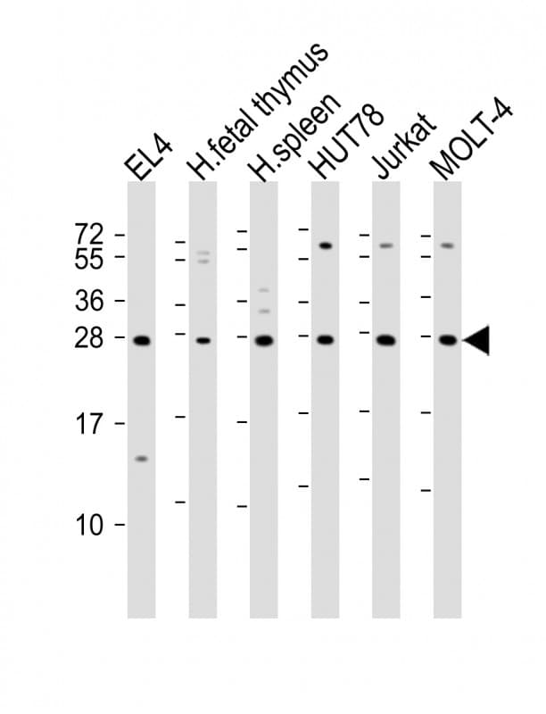 Polyclonal Rabbit anti-Human TIGIT Antibody (WB)