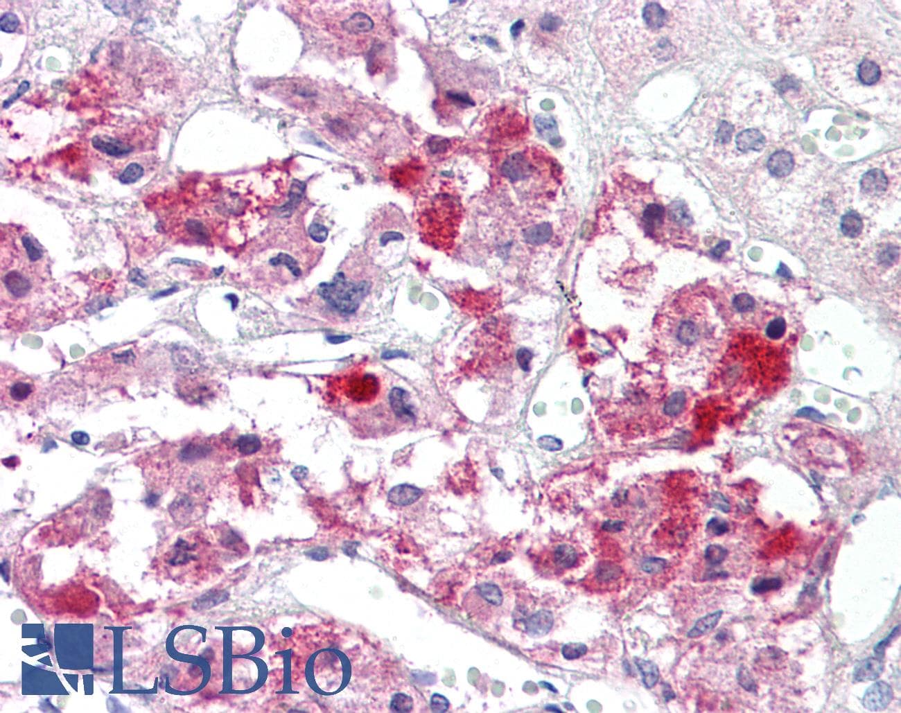 PathPlus™ Polyclonal Rabbit anti-Human BAD Antibody (aa119-168, IHC, WB)