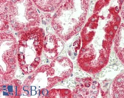 PathPlus™ Monoclonal Mouse anti-Human APOE / Apolipoprotein E Antibody (clone 4E4, aa100-150, IHC, WB)