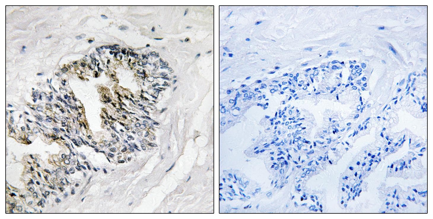RPLP2 Antibody
