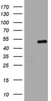 HMBS / PBGD Antibody (clone OTI3F4)