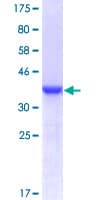 Human S100A4 / FSP1 Protein (Recombinant GST)
