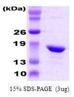 Human CRYAB / Alpha B Crystallin Protein (Recombinant)