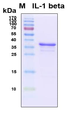 Human IL-1B / IL-1 Beta Protein (Recombinant 6His, N-terminus)