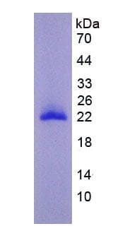 Mouse MMP9 / Gelatinase B Protein (Recombinant His, N-Terminal)