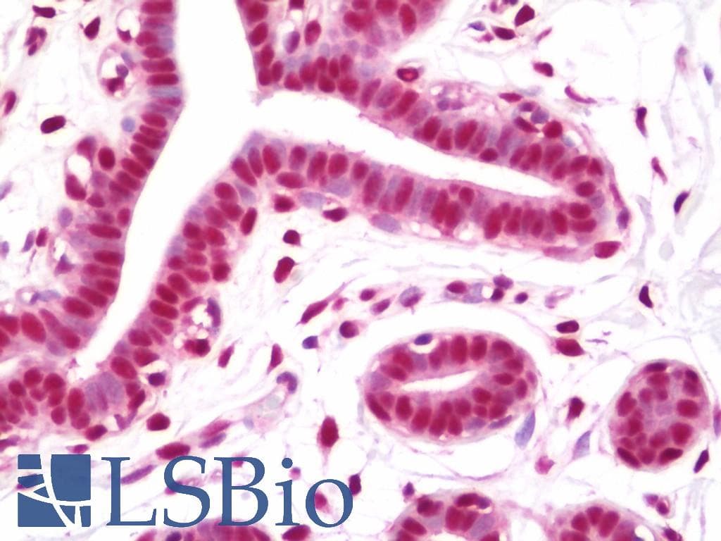 IHC-plus™ Polyclonal Rabbit anti-Human NFYC Antibody (aa408-458, IHC)