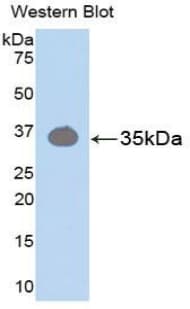PRKCB / PKC-Beta Antibody (aa342-600)