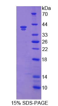 Human FCGRT / FCRN Protein (Recombinant His, N-Terminal)