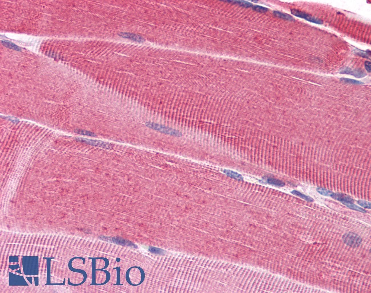 IHC-plus™ SRPK1 Antibody (clone 6H5)