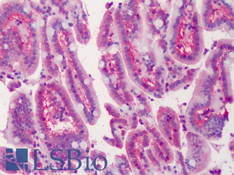 IHC-plus™ Polyclonal Goat anti-Human LASP1 Antibody (aa141-153, IHC, WB)