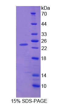 Rat CDNF / ARMETL1 Protein (Recombinant His)